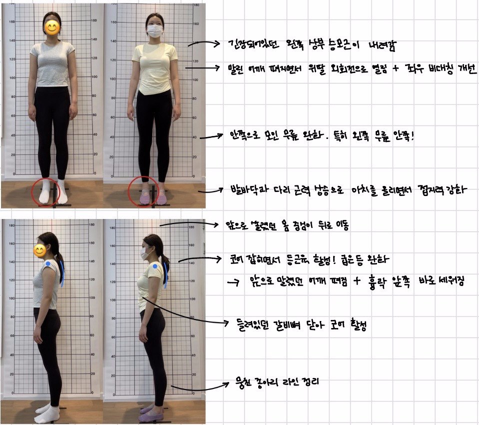 정면·측면 체형 변화 비교, 바디엔필라테스 1:1 개인레슨